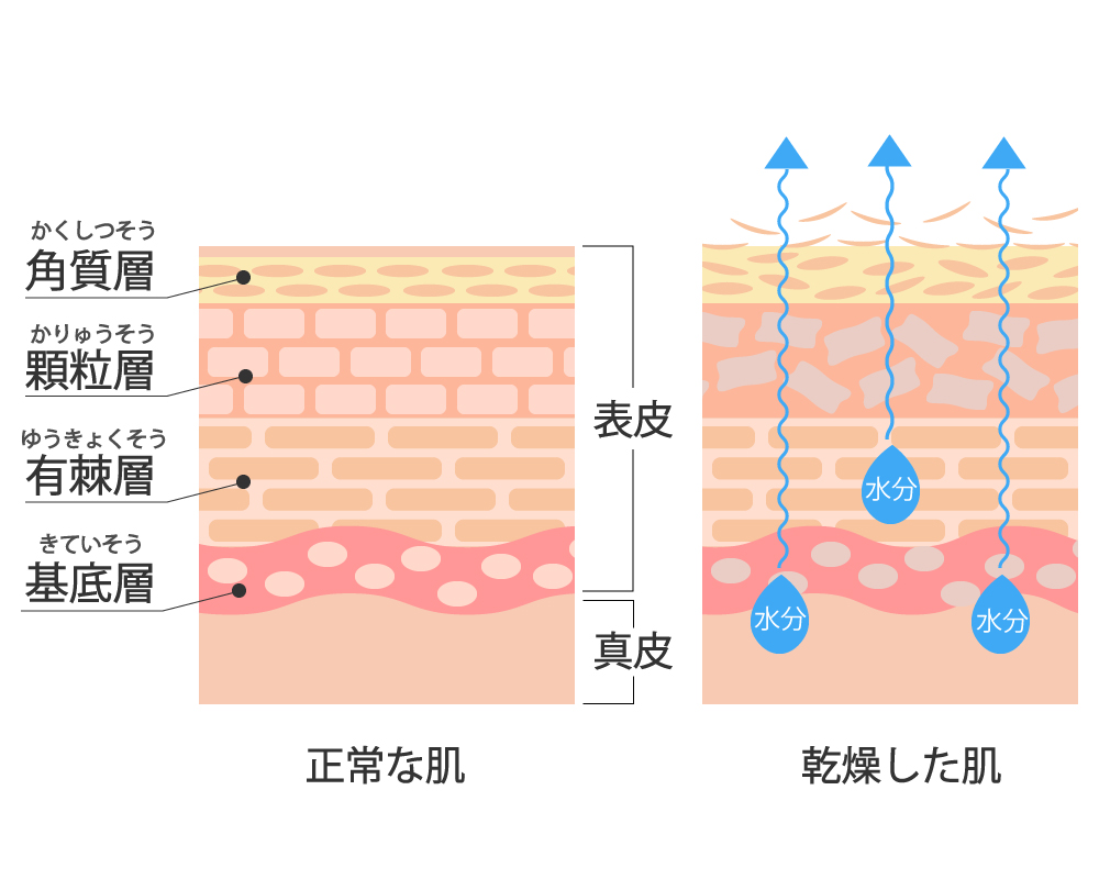 角質,肌荒れ,ニキビ